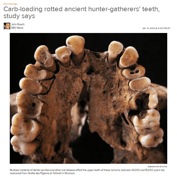 Carb-loading rotted ancient hunter-gatherers teeth, study says
