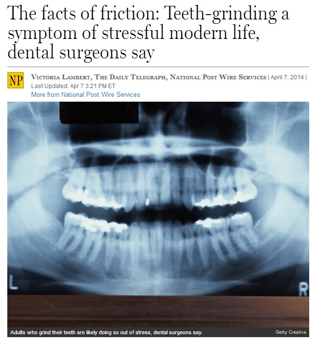 The facts of friction-Teeth-grinding a symptom of stressful modern life, dental surgeons say