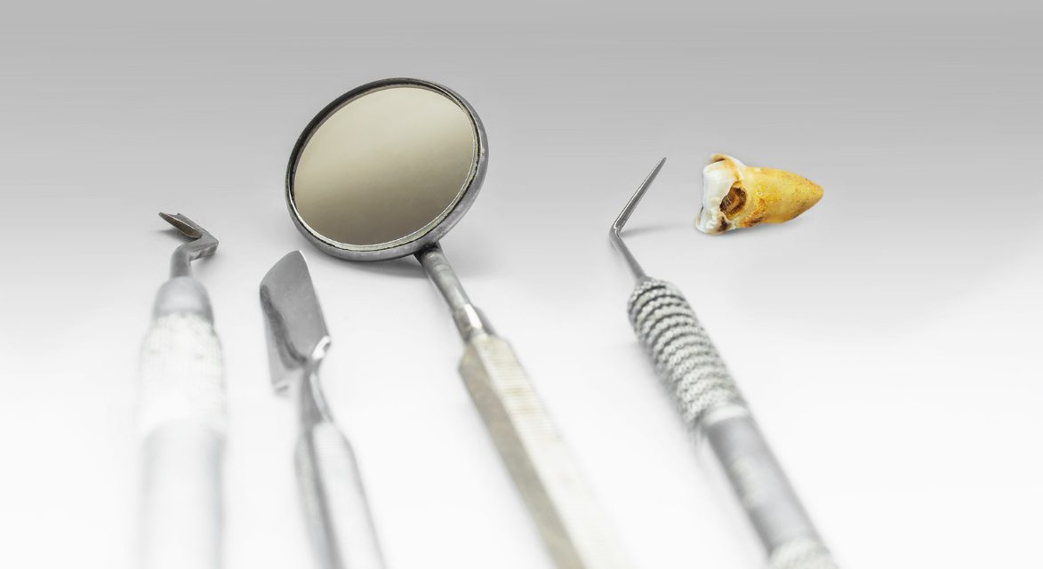 tips what to expect wisdom tooth removal